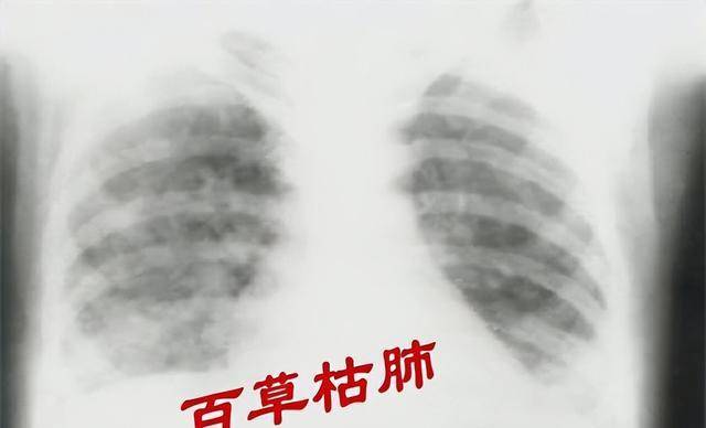 “百草枯之父”李德军：百草枯卖了多少年，我就愧疚了多少年！
