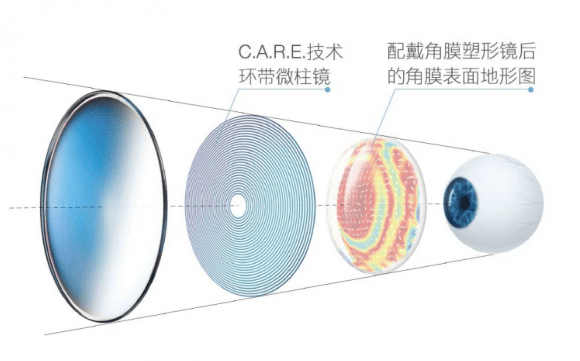 防控镜片什么意思